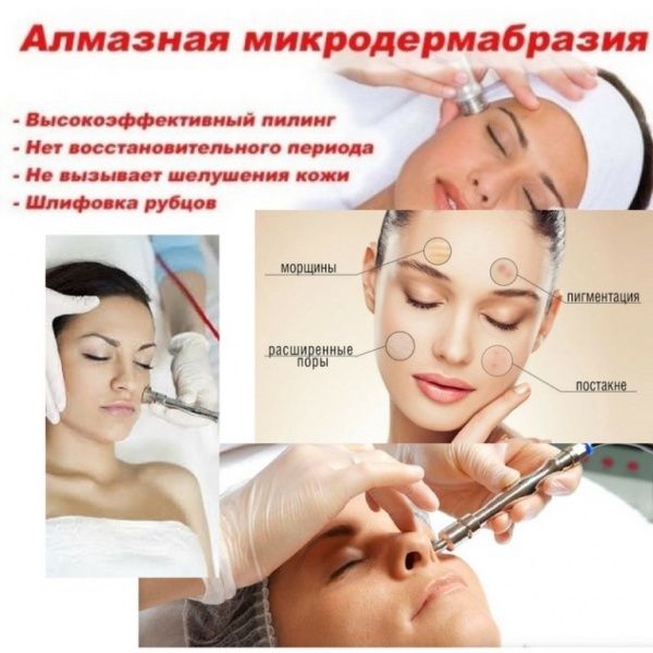 24213 Аппарат алмазной микродермабразии Nova NewFace NV-60 Nova NewFace (НОВА НьюФейс)  - Вид №1