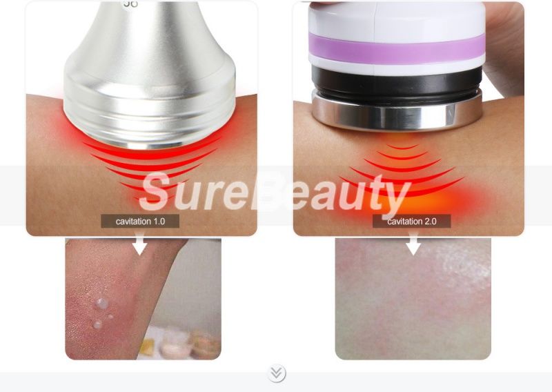 37908 Аппарат ультразвуковой кавитации 40K Unoisetion 2.0 Mychway  - Вид №7