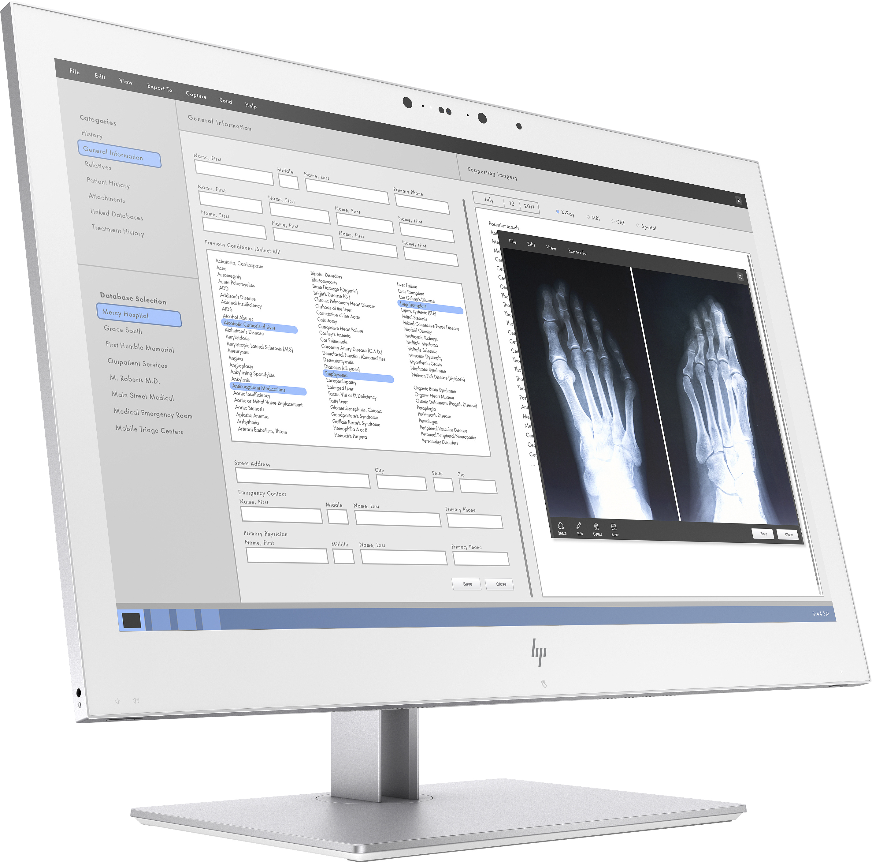 1QW03AA#ABB healthcare edition hc270cr qhd clinical review monitor 350 cd/m2 1000:1 12ms 178°/178° vga hdmi dp 2560x1440 led backlight swivel tilt pivot HP Santreyd  - Вид №4