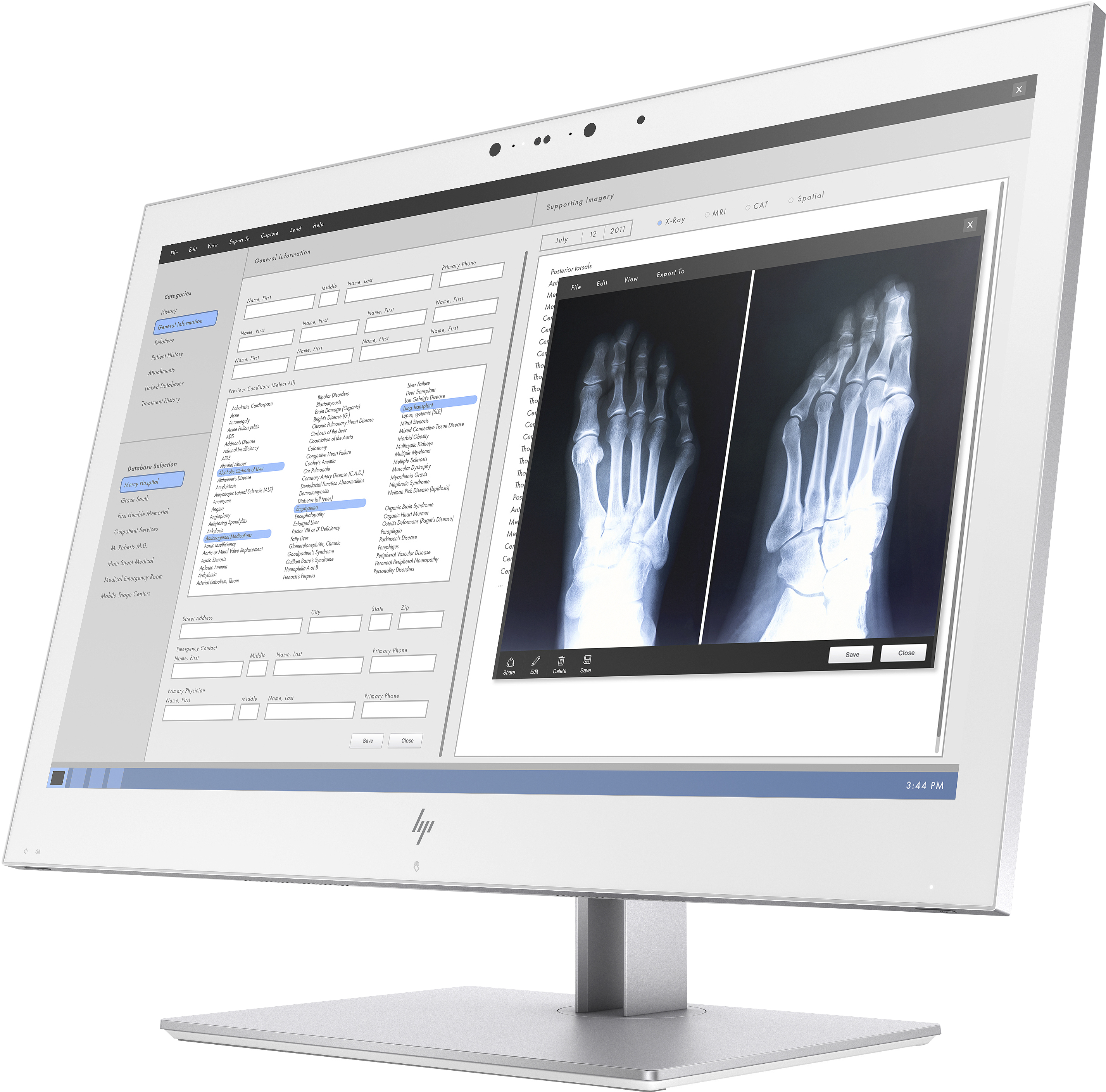 1QW03AA#ABB healthcare edition hc270cr qhd clinical review monitor 350 cd/m2 1000:1 12ms 178°/178° vga hdmi dp 2560x1440 led backlight swivel tilt pivot HP Santreyd  - Вид №3